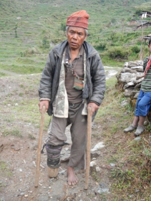 A very poor man in the village of Tipling. He lost the lower part of his right leg 24 years ago.